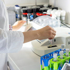 Messung des CSB-Werts einer Gewässerprobe mit Test kit